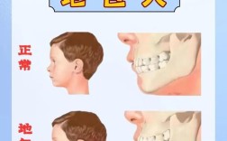 少年地包天正畸过程需要经历哪些步骤？