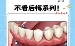 那些人不能种牙