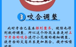 牙齿矫正一般需要多长时间完成？