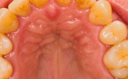 正畸牙龈周围充血是什么原因？