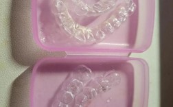 正畸舌侧保持器图片长啥样？看图了解佩戴形态与效果