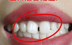 正畸牙缝不能关闭了