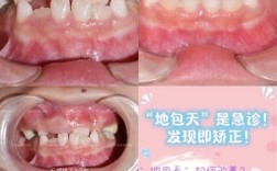 地包天正畸哪里好