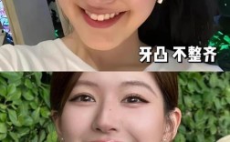 明星种牙视频合集，效果真如传言那么好？