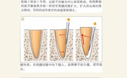 拔牙新技术，如何让拔牙更轻松、恢复更快？