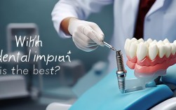 种植牙种植体哪家好