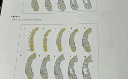 正畸支抗钉常用型号