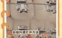 自锁托槽打开的具体操作方法有哪些？