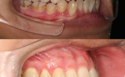 正畸拍照上下颌怎么拍？正确角度与步骤有哪些？