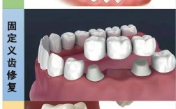 全口假牙固位不足怎么办？有哪些加强固位的实用方法？