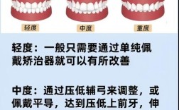 牙齿深覆合可以通过正畸矫正吗？