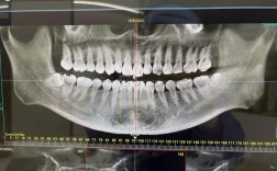 矫正牙齿需要拍片