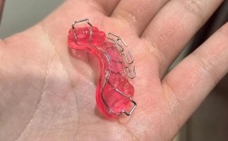 正畸反颌矫治器图片
