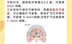 牙列拥挤正畸方案