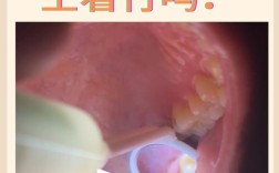 拔牙后若一直不种牙，邻牙真的会歪斜、牙槽骨会加速萎缩吗？对身体还有哪些隐藏影响？