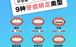 牙齿矫正有哪些类型？哪种更适合自己？