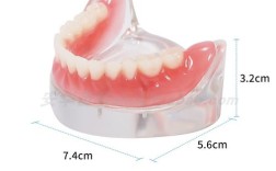 四颗 半口 种牙