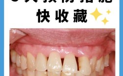 矫正牙齿导致牙龈萎缩