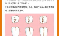 牙齿裂开最好的解决方法是什么？