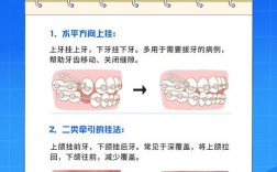 正畸垂直牵引的步骤