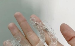 郑州3d数码隐形正畸