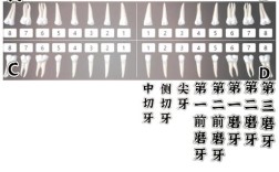 植牙数位照是什么？它如何提升植牙精准度？
