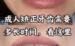 矫正牙齿多久见效