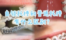 牙齿矫正器矫正牙齿的具体步骤和原理是什么？