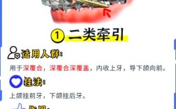 正畸牵引力大小具体