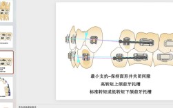 口腔正畸隐形矫正的核心要点与注意事项有哪些？