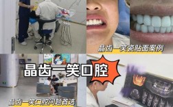 氟斑牙正畸哪种矫正方式更合适？