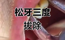 正畸拔牙后牙齿松动，是正常现象吗？如何处理？