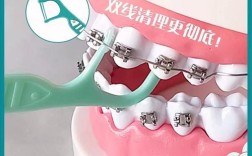 正畸清理牙齿工具