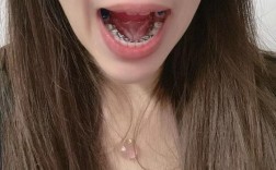 舌侧矫正对牙齿咬合的调整效果具体如何？