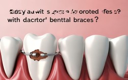 蛀牙未治好，牙齿矫正能做吗？会有影响吗？