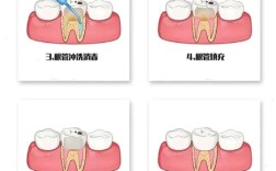 牙髓充血的正确处理方法有哪些？不同病因和症状阶段的治疗方案与注意事项有何差异？