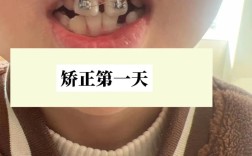 惠州牙齿矫正机构怎么选？