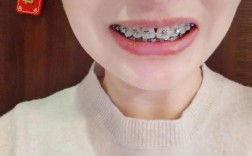 正颌术前正畸四个月时长够用吗？效果能达标吗？