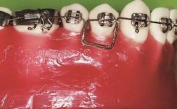 正畸弓丝弯制比赛6