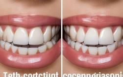 2025牙齿矫正后对比，效果真的能逆袭颜值吗？