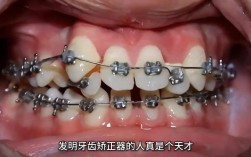 牙齿矫正该去哪里做？靠谱机构怎么选？