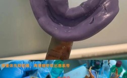 在精密附件修复中，如何选择合适的取模方法以确保印模精度和边缘适合性？