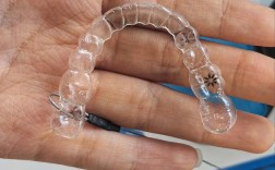 牙齿矫正用什么材料