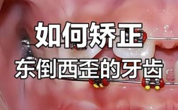 正畸过程中施力不当为何会让牙齿拉歪？