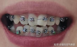 广州光华口腔医院正畸效果真的靠谱吗？不同年龄做正畸有什么区别？技术设备和医生团队如何保障效果？