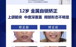 错合畸形的治疗方法有哪些？如何根据畸形类型选择？