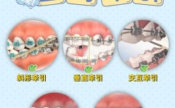 高密度无痕正畸治疗法