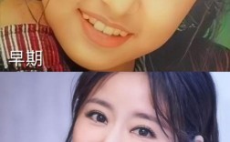 林心如矫正牙齿图片引猜测，为何突然矫正？效果引关注？