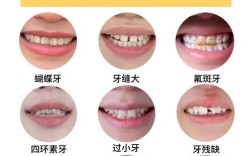 种牙后服用四环素会影响种植体骨结合效果或引发不良反应吗？