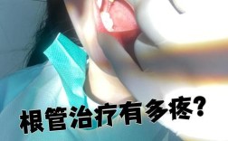 矫正牙齿打麻药疼不疼？